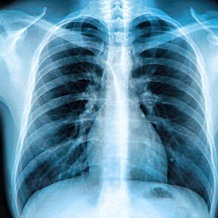 Influenceurs en radiologie